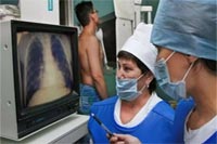 О результатах надзора за туберкулезом в ЗАО в 2017 году